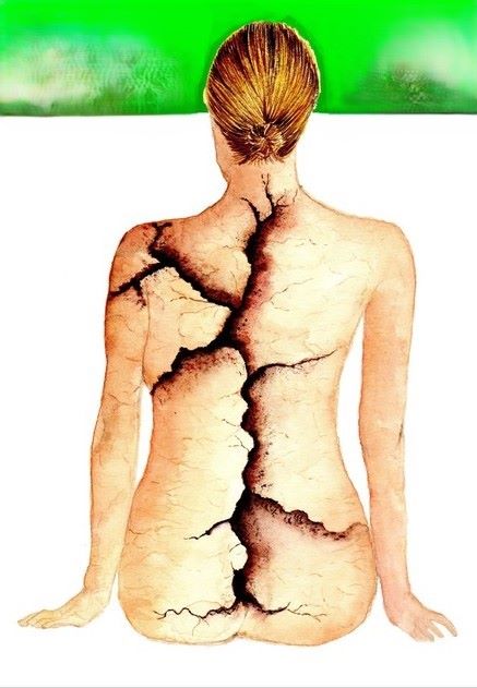 Blog over nekartrose - afbeelding van gebroken rug - nekartrose-pijnklachten-fibromyalgie-osteoporose