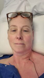 Nekartrose blog - Net wakker uit de narcose - Rina van Loenen - nekartrose-pijnklachten-fibromyalgie-osteoporose