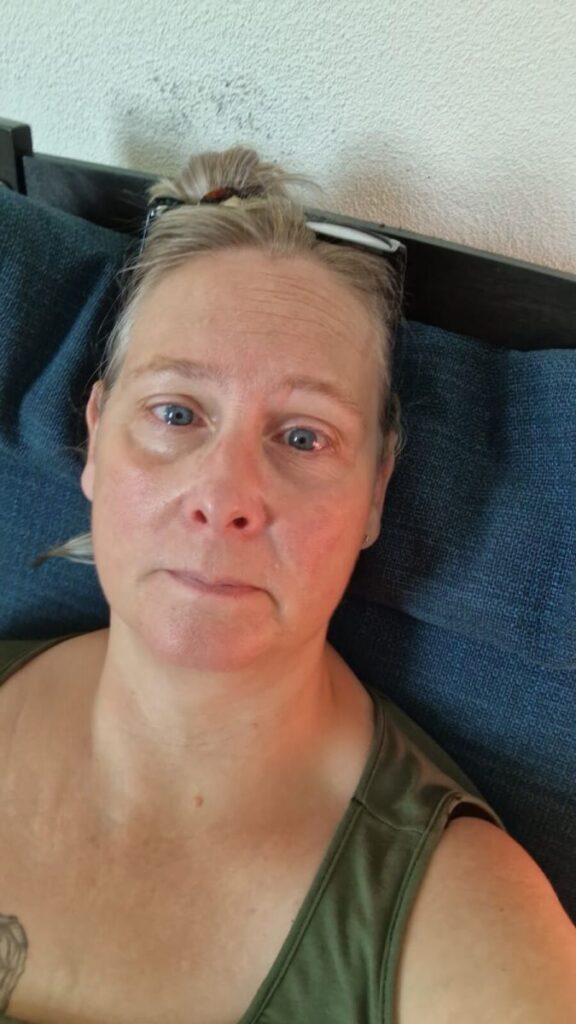 Nekartrose blog - Rauwe waarheid achter mijn pijn de afgelopen maanden - Rina van Loenen - nekartrose-pijnklachten-fibromyalgie-osteoporose